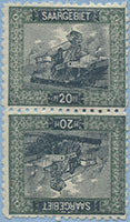 921.06-Tb B (Tooth 10, 140,0 $)