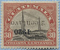 920.01-V V ( ** 70,0 $) Tooth 14 Inscription Invert
