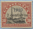 920.01-D I ( *  15,0 $) Tooth 15