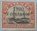 920.01-D II ( *  5,0 $) Tooth 14
